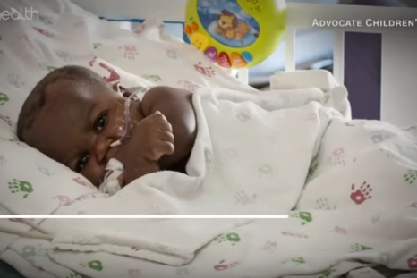 9-month old Dominique was able to have the legs and feet protruding from her neck and back successfully removed.
