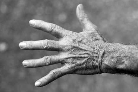 In its early stages, Parkinson's disease is often characterized by shaking of the hands.