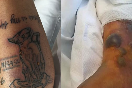 Man dies from flesh-eating bacteria after swimming in the Gulf of Mexico five days after getting a new tattoo.