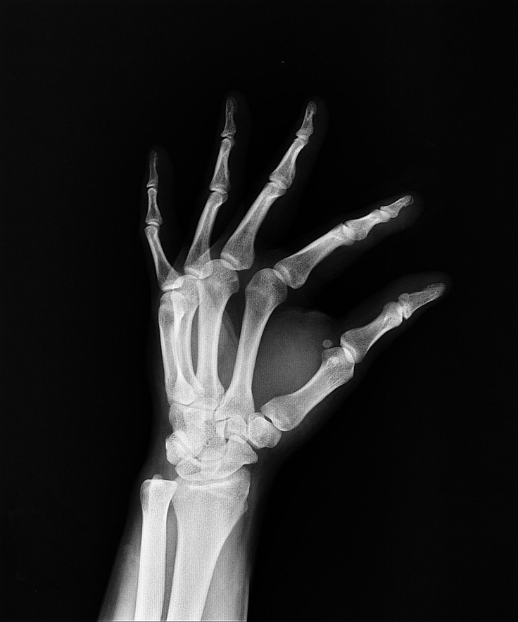 x-ray-1704854_1920