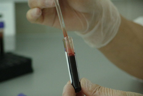 A blood test for cancer could aid in early detection.