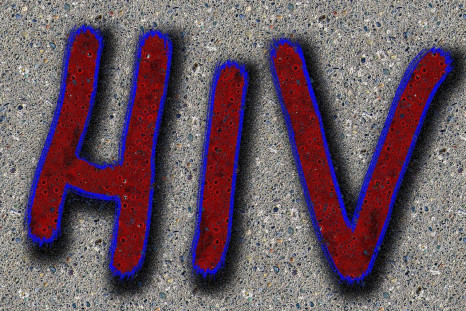 Clients of a vampire facial spa tested positive for HIV.