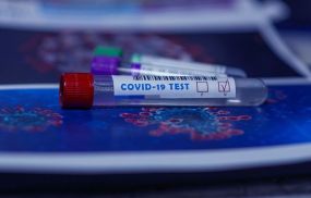 The Centers for Disease Control and Prevention (CDC) issued a guidance saying antibody tests may not always provide accurate results to identify COVID-19 infections.