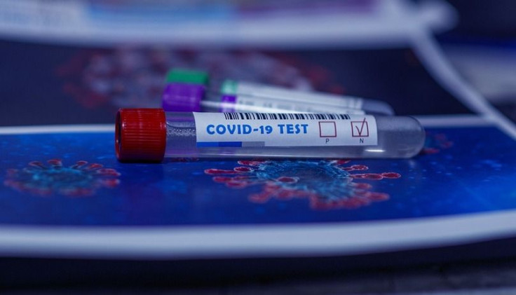 COVID-19 antibody test