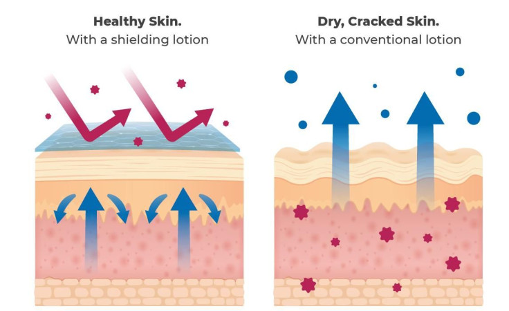 Healthy Skin Vs Dry Skin