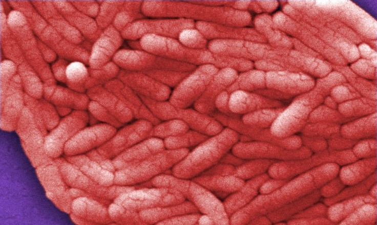 143024-file-photo-of-salmonella-bacteria
