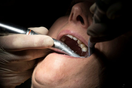 Dentists ask that people leave the dental work to the professionals.