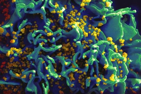 An HIV infected T-cell.