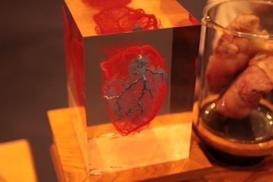A 3D representation of the human heart.