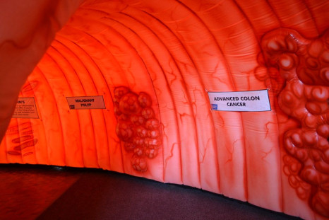 An inflatable colon display at the Henry Ford Hospital, designed to raise awareness for Colorectal Cancer Awareness Month.