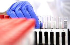 Employees examine the coronavirus (Covid-19) PCR gargle tests in the LifeBrain laboratory in Vienna on February 1, 2022.