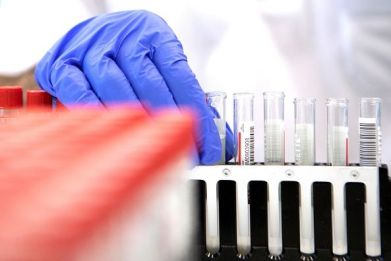 Employees examine the coronavirus (Covid-19) PCR gargle tests in the LifeBrain laboratory in Vienna on February 1, 2022.