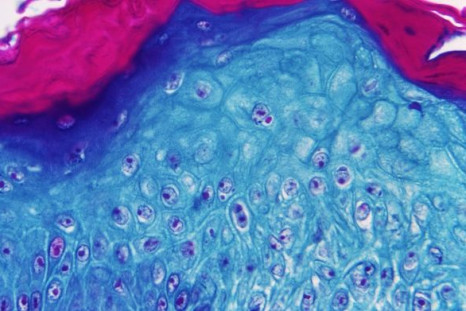 Under a microscope magnification of 500X, this image depicted a section of skin tissue, harvested from a lesion on the skin of a monkey, that had been infected with monkeypox virus, 1968. Courtesy CDC.