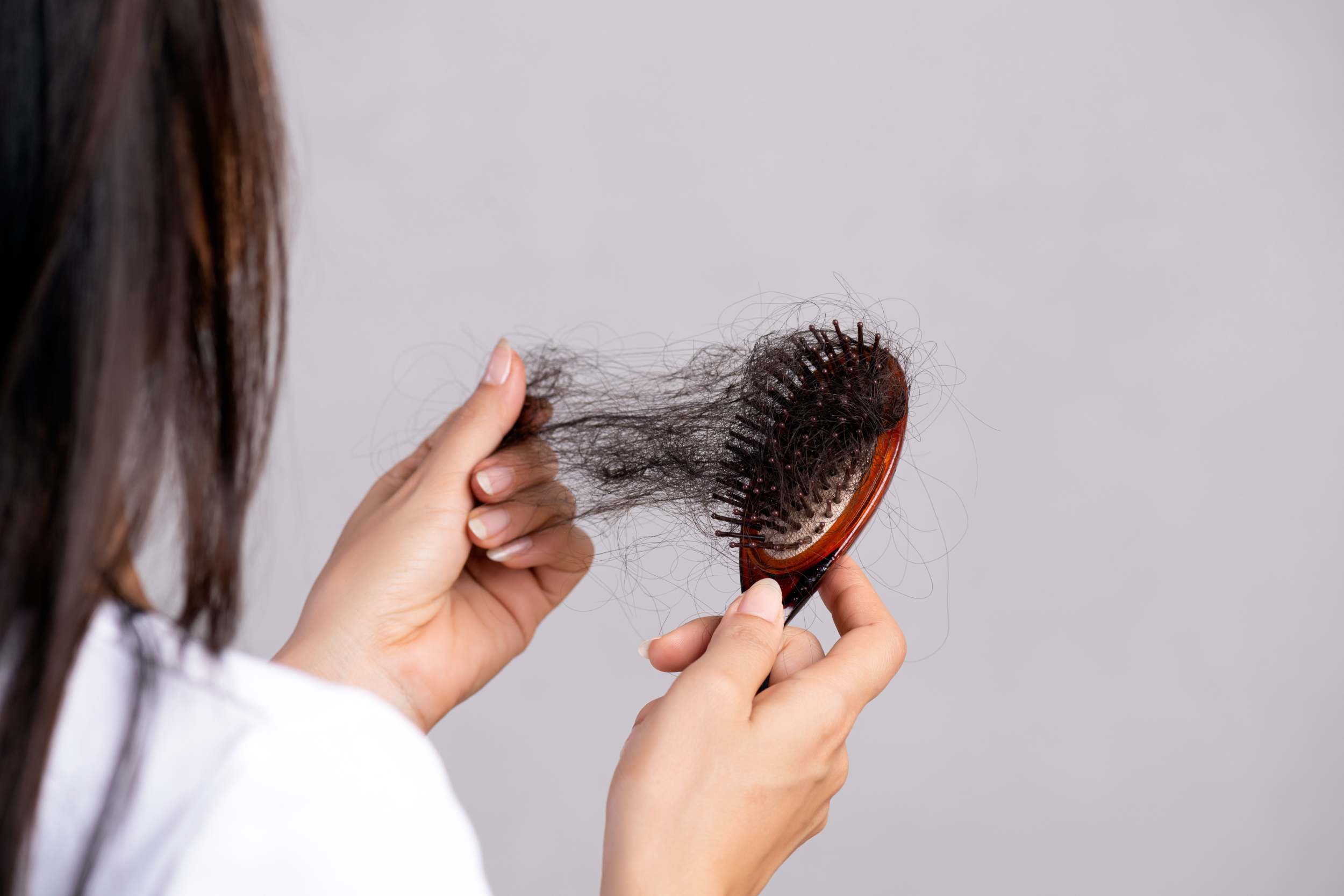 Can COVID-19 Infection Cause Hair Loss?
