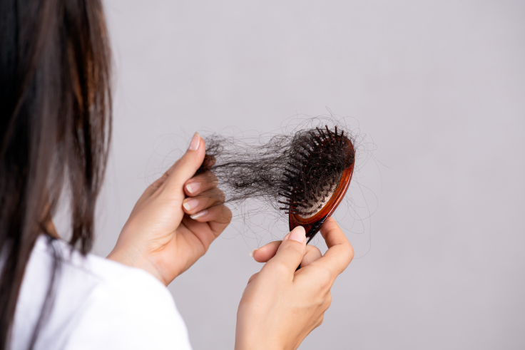 Female pattern hair loss