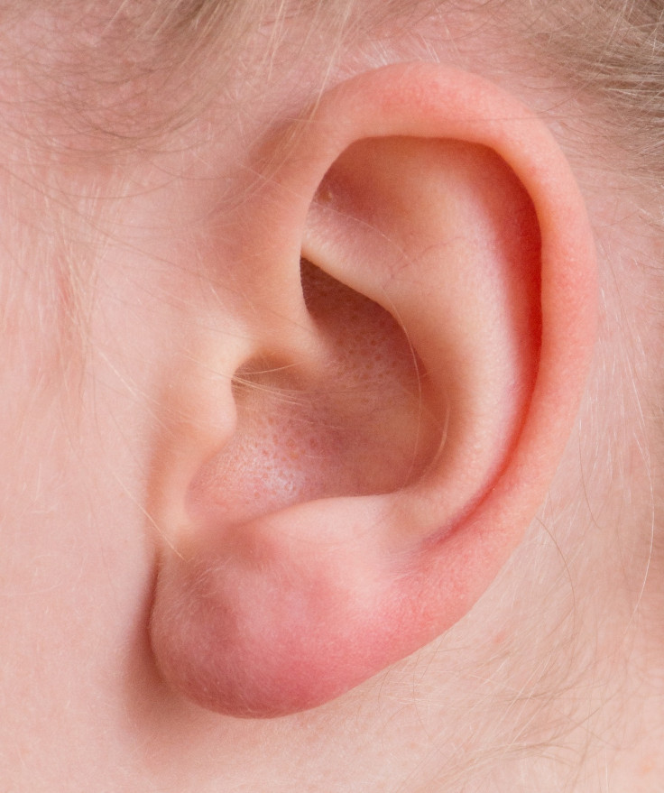گوش درد شدید ممکن است به دلیل 