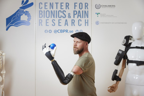 The patient wears a prosthetic arm directly attached to the skeleton and neuromuscular system, which after surgical reconstruction of his residual limb, allows him to control individual fingers of a bionic hand.