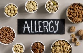 food allergies