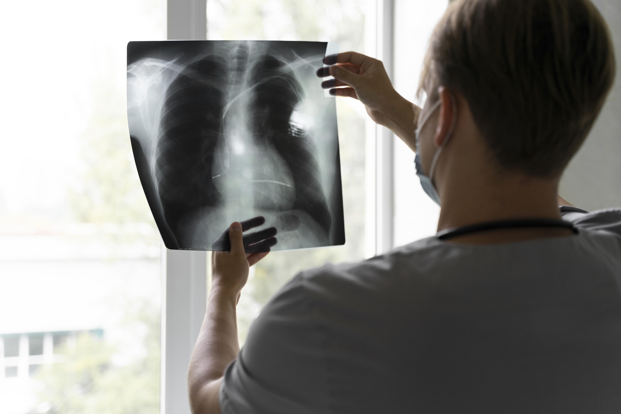 Younger Non-Smoker Died Of Terminal Lung Most cancers After Signs Have been Initially Dismissed As Nervousness