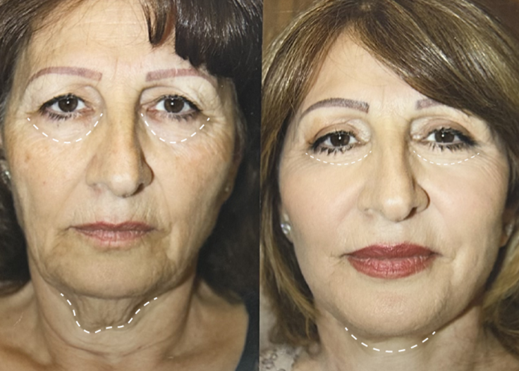 Dr. Susan Chobanian
