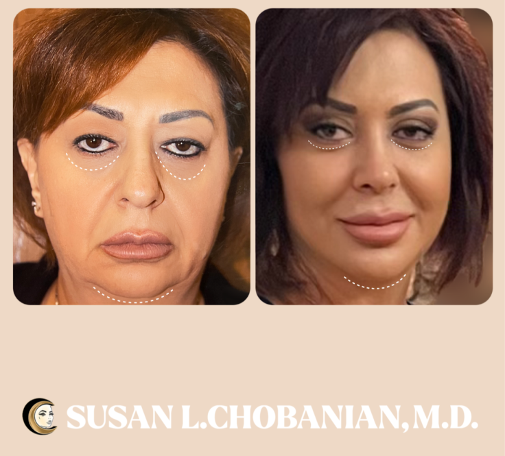 Dr. Susan Chobanian