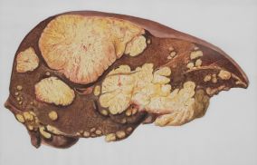 Liver Anatmoy