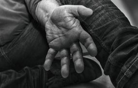 Understanding why hand tremors happen: from anxiety-induced shaking hands causes to essential tremor symptoms. Learn triggers, differences from Parkinson's, and when to seek help.