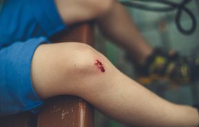Person with a Wound on their knee