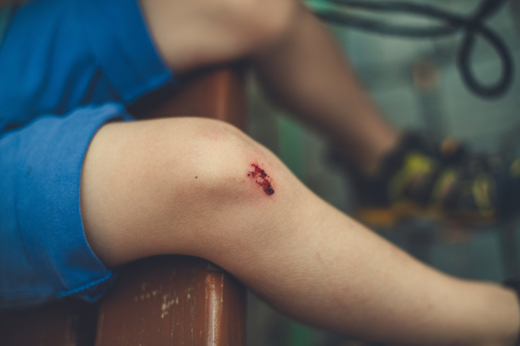 Person with a Wound on their knee