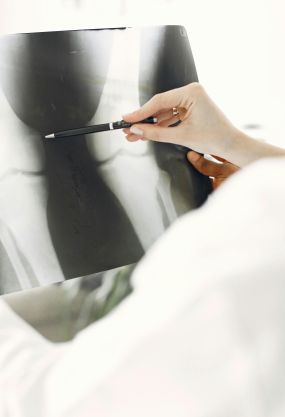 Doctor Looking at Legs Roentgen