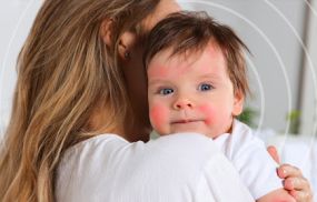 Damaged Skin Barrier Repair from the Inside Out to Fight