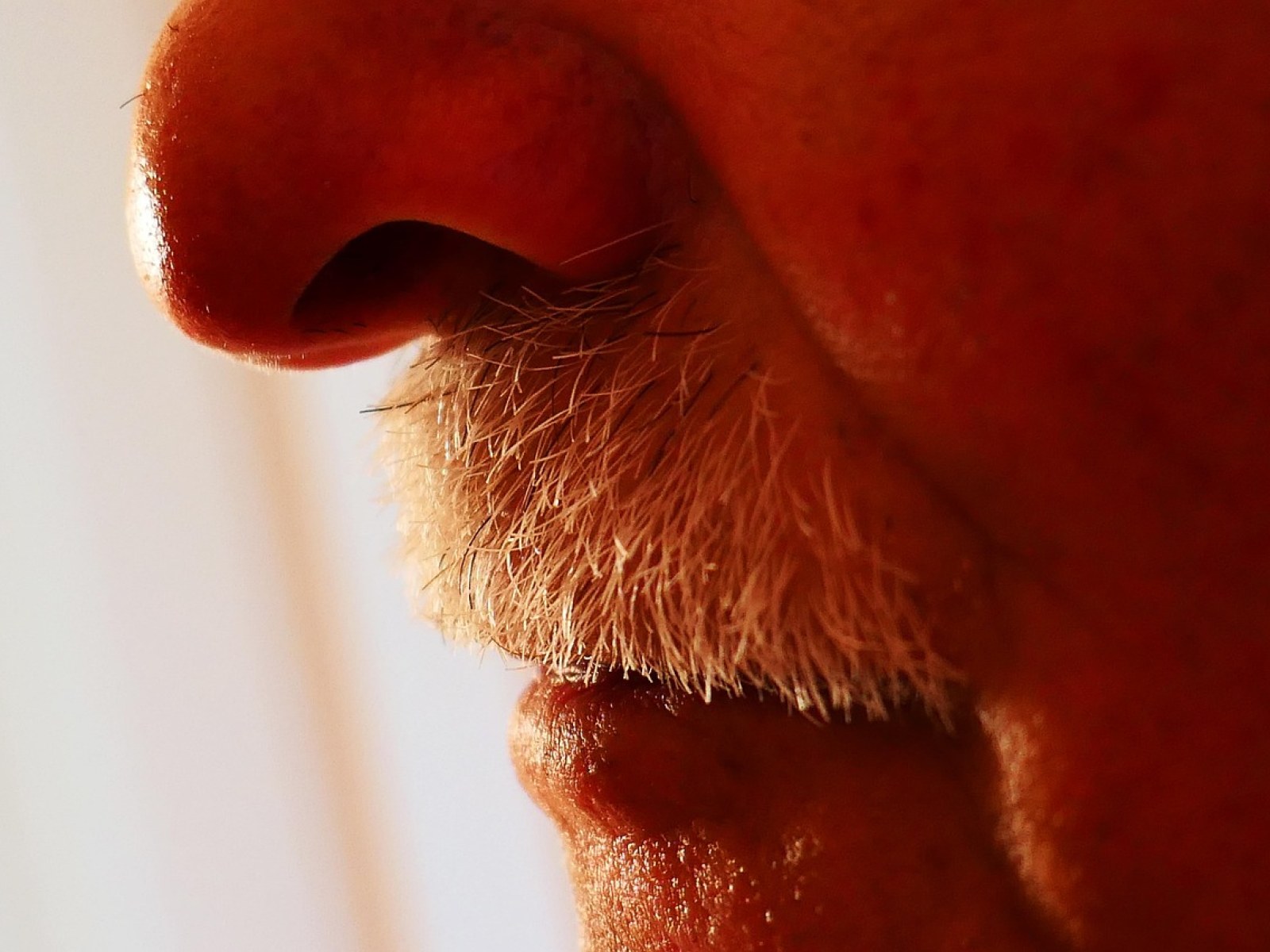 What Frequent Nosebleeds Reveal about Dryness, Local Irritation, and a Possible Clotting Disorder
