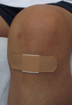 Injury