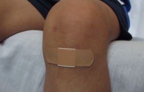 Injury