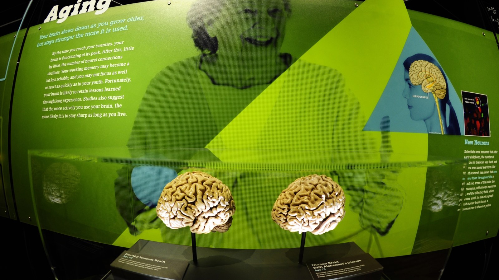 New Study of 4,000 Adults Shows Brain Health Can Improve at Any Age — Even in Your 80s and 90s