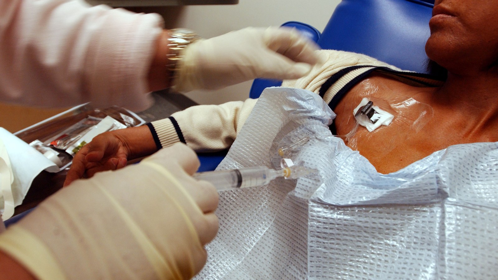 Tuberculosis Cases in the U. S. Just Hit a Multi-Decade High: Public Health Experts Are Alarmed