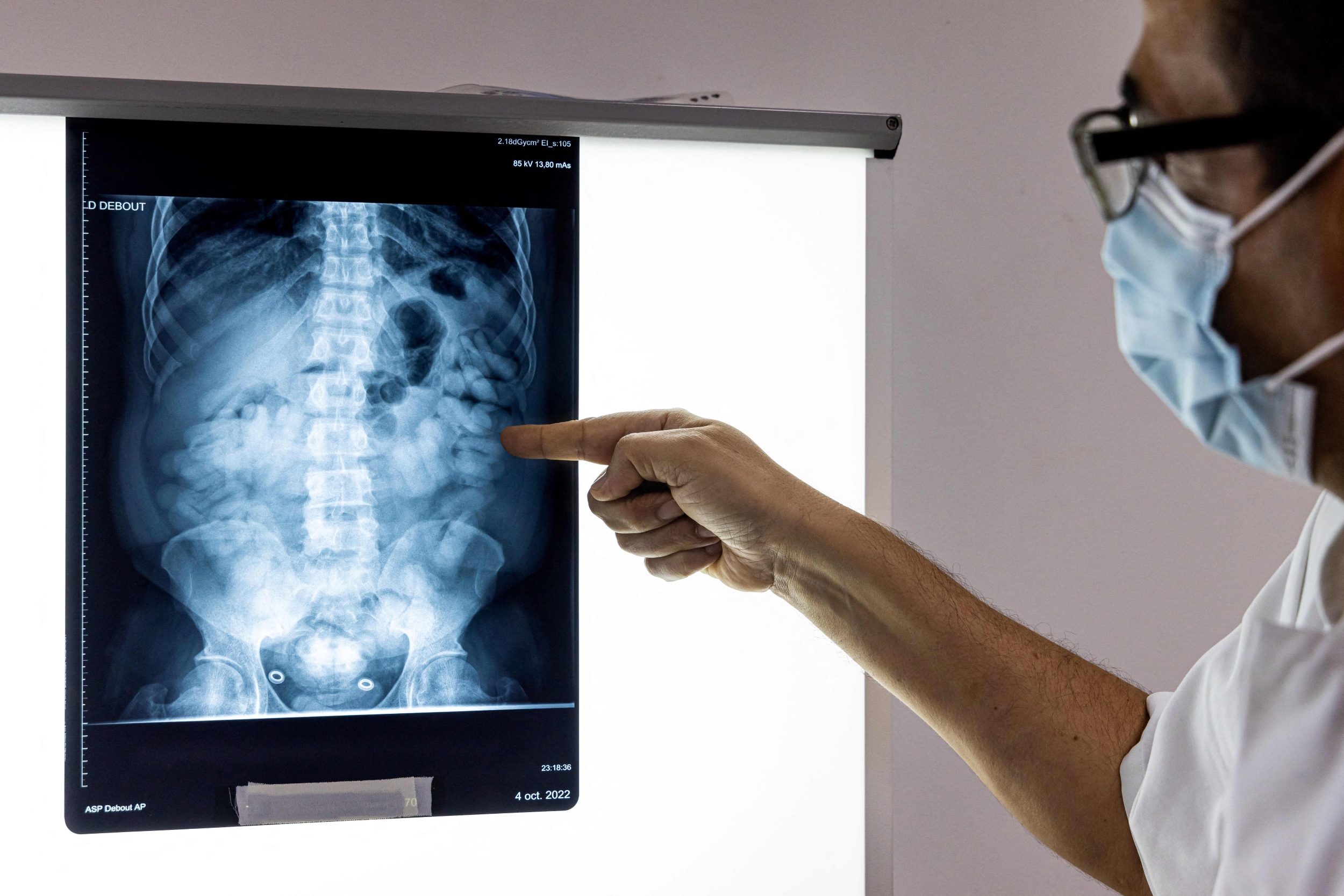The Man Who Wants to Live Forever Bryan Johnson Is Diagnosed with Incurable Autoimmune Gastritis