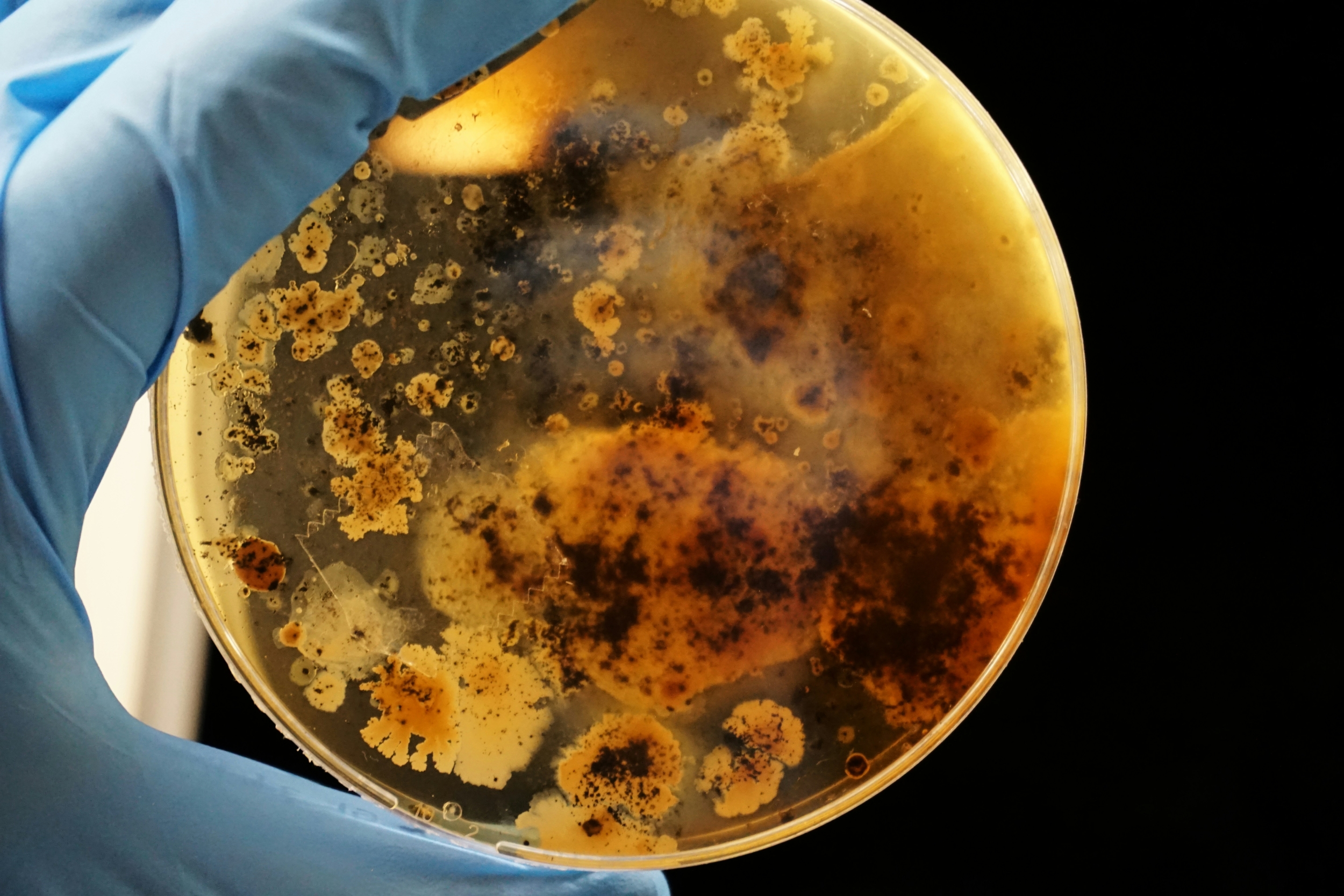 Drug-Resistant Candida Auris Confirmed in 23 States as CDC Logs More Than 3,000 Cases This Year
