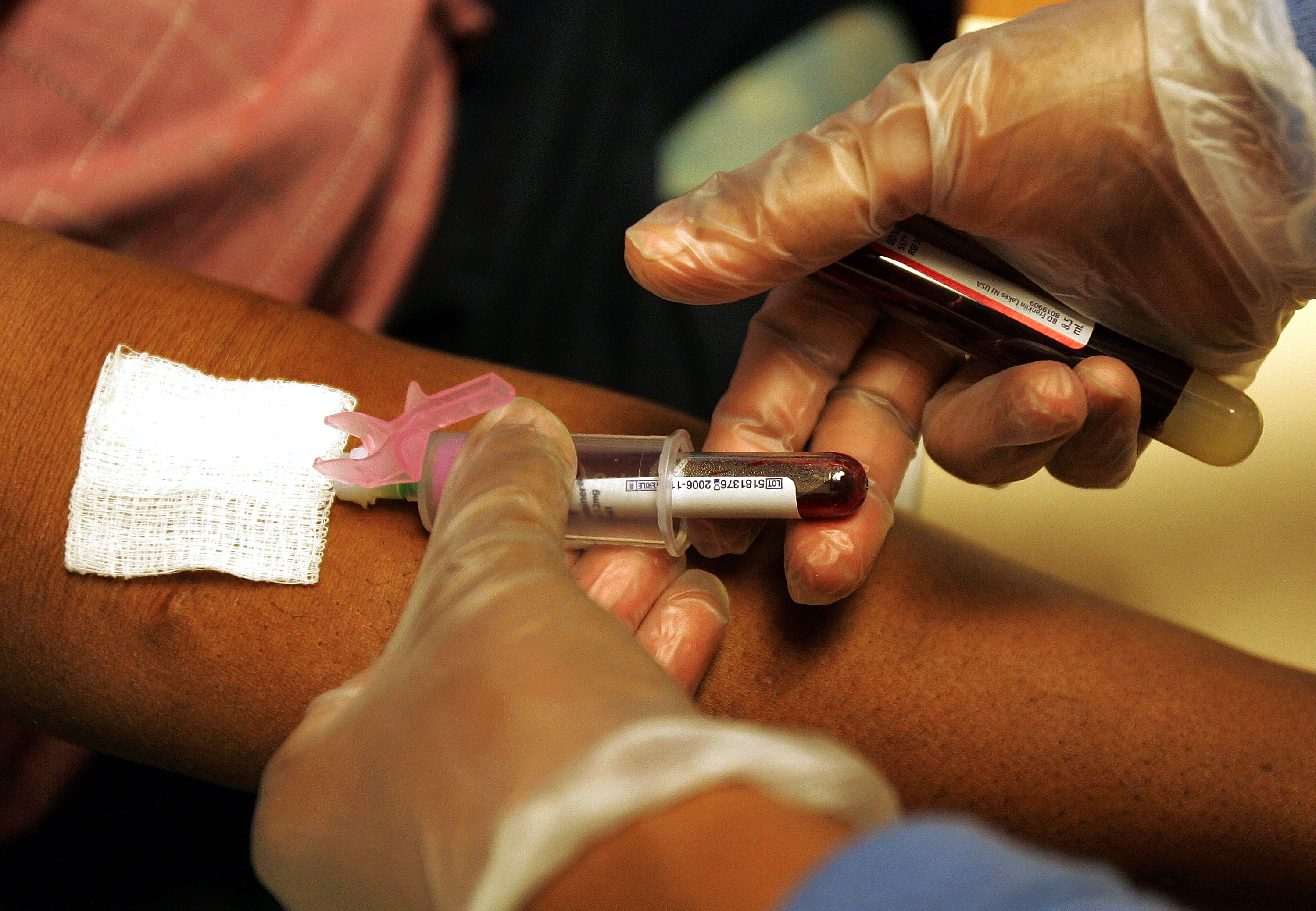 FDA Clears a Second Colorectal Cancer Blood Test, and the Trade-Off Is in What It Misses