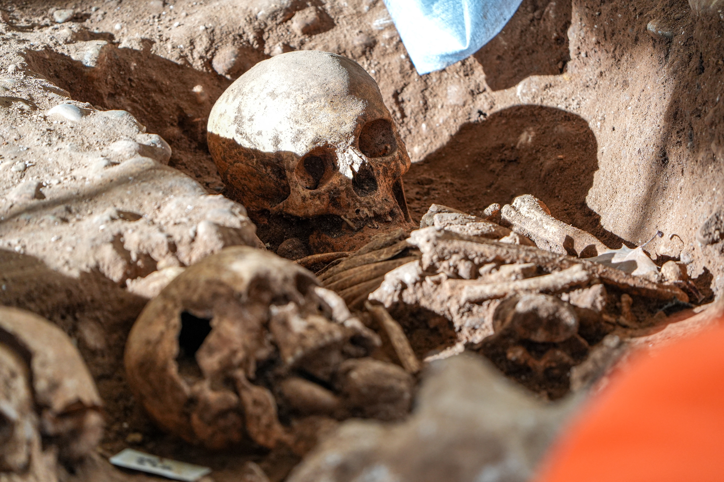 Ancient Skeletons from 3,500 Years Ago Are Challenging What Scientists Thought About Syphilis and Its Origins