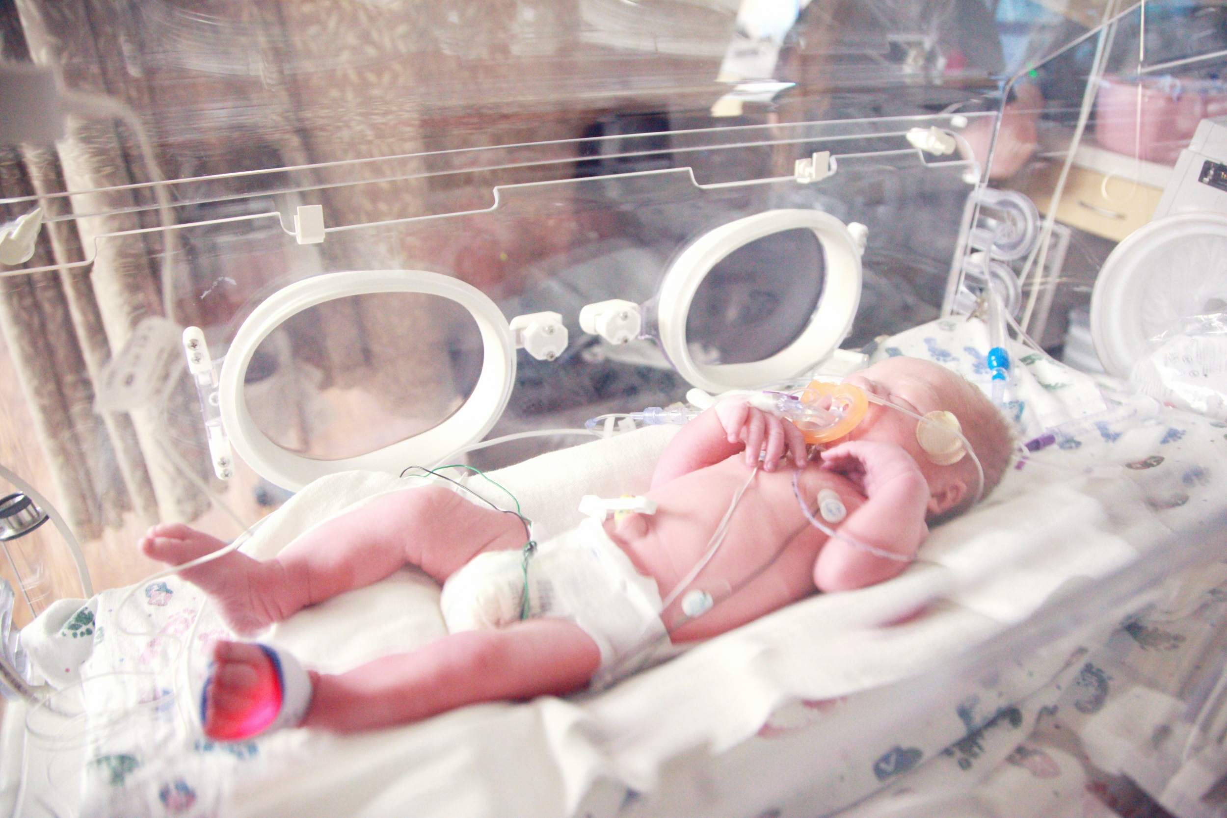 Postmortem Reviews Found Four in Five Stillbirths and Child Deaths in Africa and South Asia Were Potentially Preventable