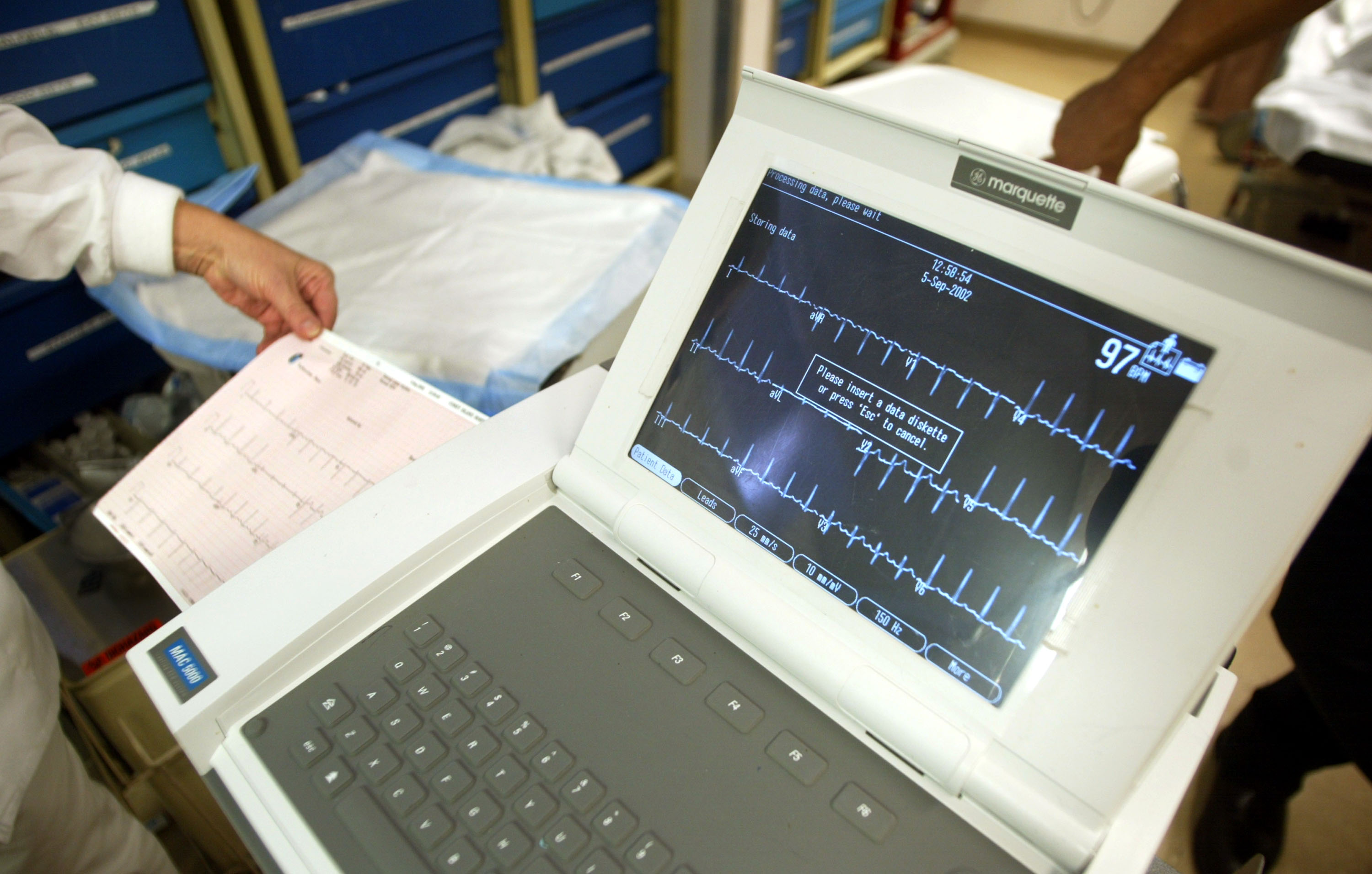 AI EKG Tool Authorized by FDA Aims to Flag Heart Attacks That Standard ST-Elevation Criteria Can Miss