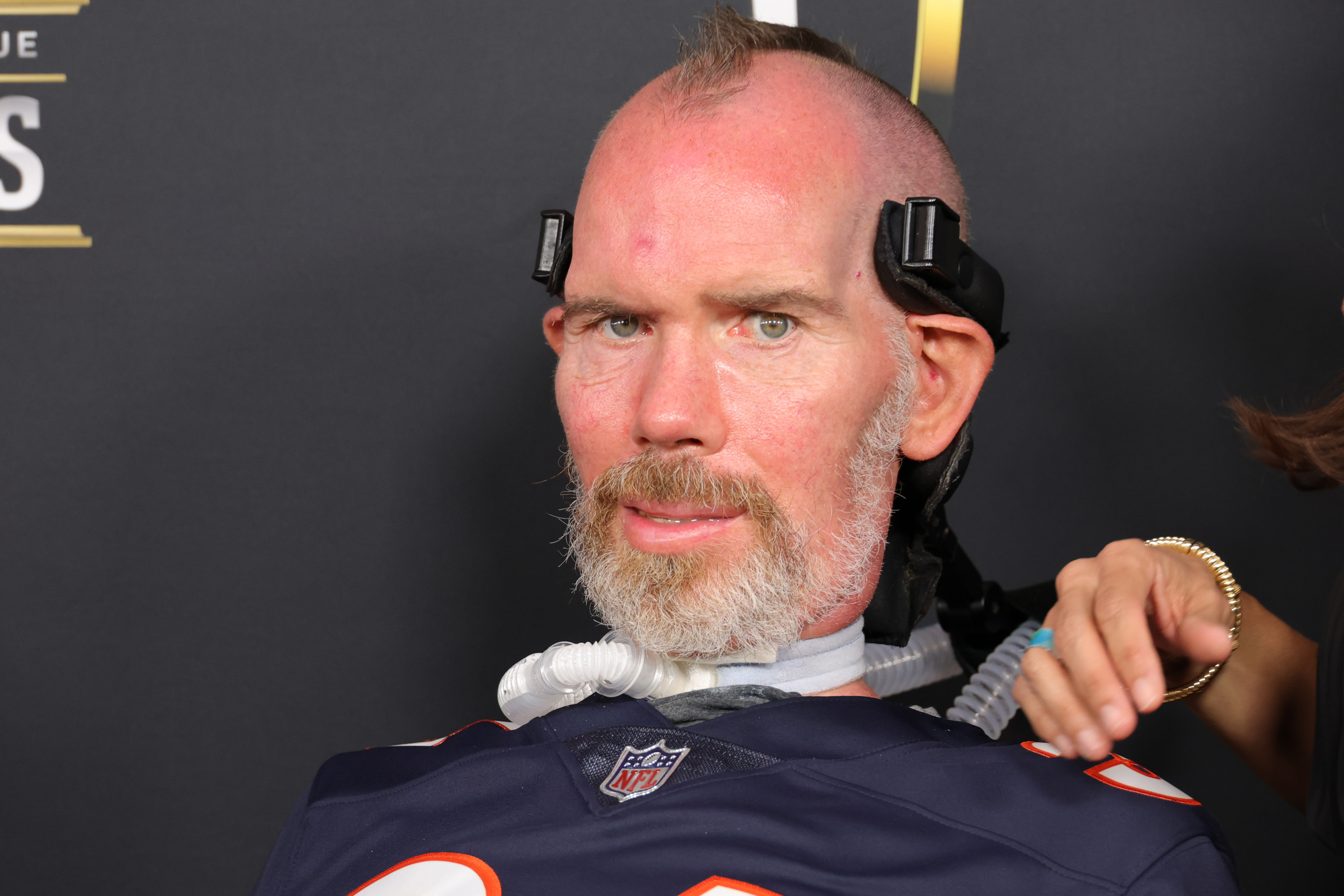 Steve Gleason, exjugador de seguridad de los New Orleans Saints diagnosticado con ELA en 2011. Crédito: Michael Loccisan