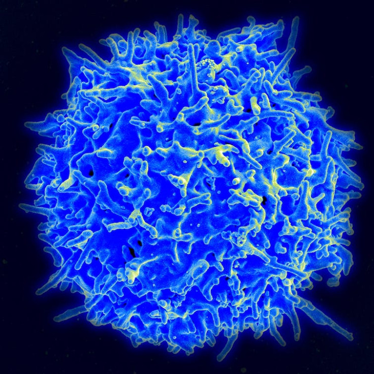 A healthy human T cell, a large blue rumpled sphere
